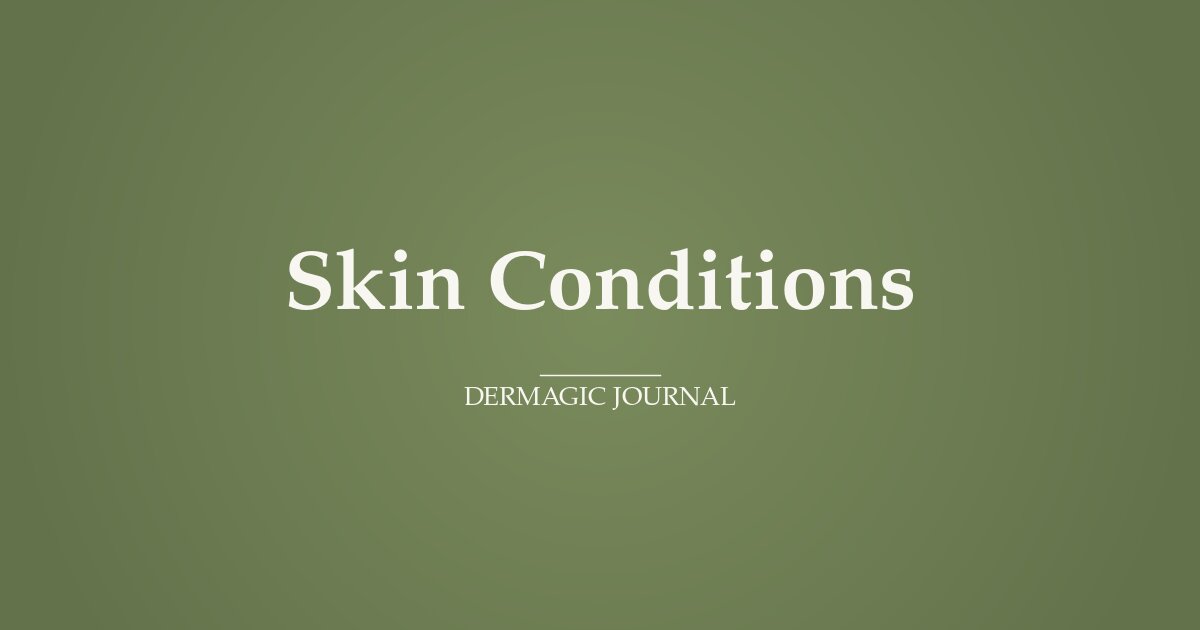 Dog Skin Problems Caused by Parasites: Fleas, Ticks and Mites